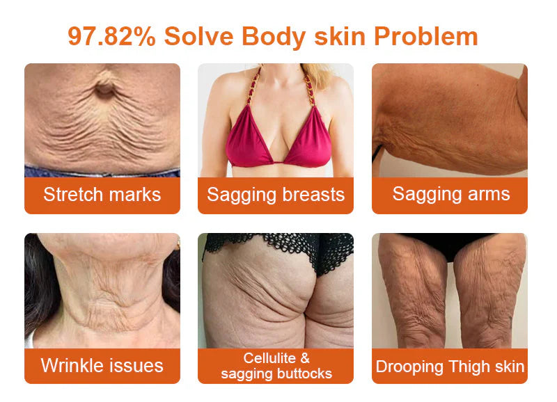 𝐓𝐚𝐠-𝐜𝐮𝐫𝐞 𝐁𝐞𝐞 𝐯𝐞𝐧𝐨𝐦