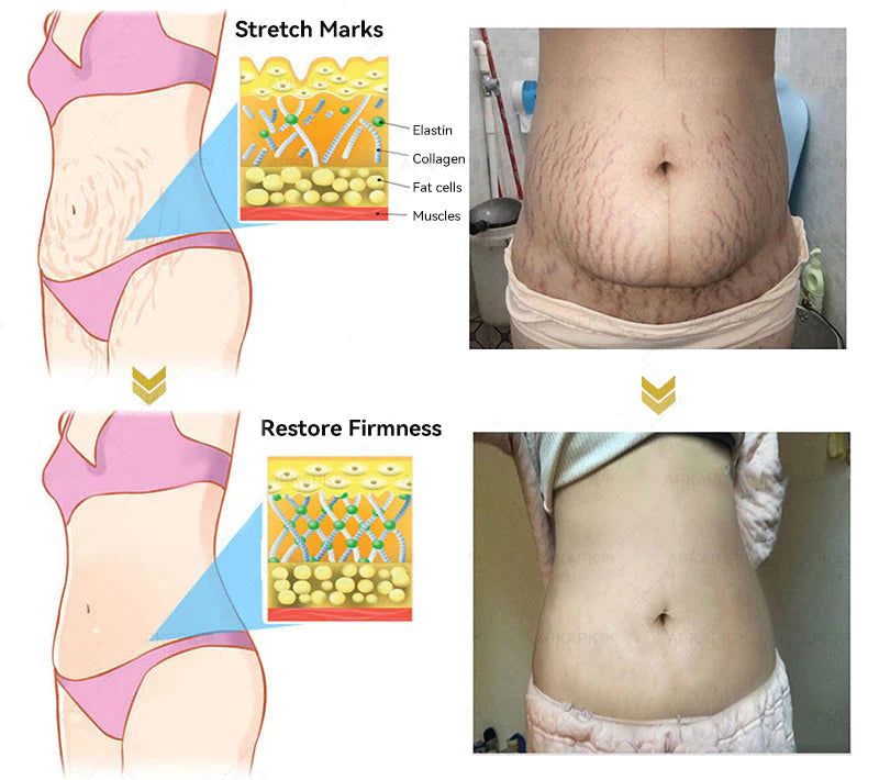 𝐓𝐚𝐠-𝐜𝐮𝐫𝐞 𝐁𝐞𝐞 𝐯𝐞𝐧𝐨𝐦