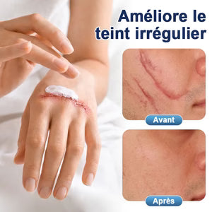 𝐂𝐫𝐞̀𝐦𝐞 𝐫𝐞́𝐩𝐚𝐫𝐚𝐭𝐫𝐢𝐜𝐞 𝐝𝐞 𝐜𝐢𝐜𝐚𝐭𝐫𝐢𝐜𝐞𝐬