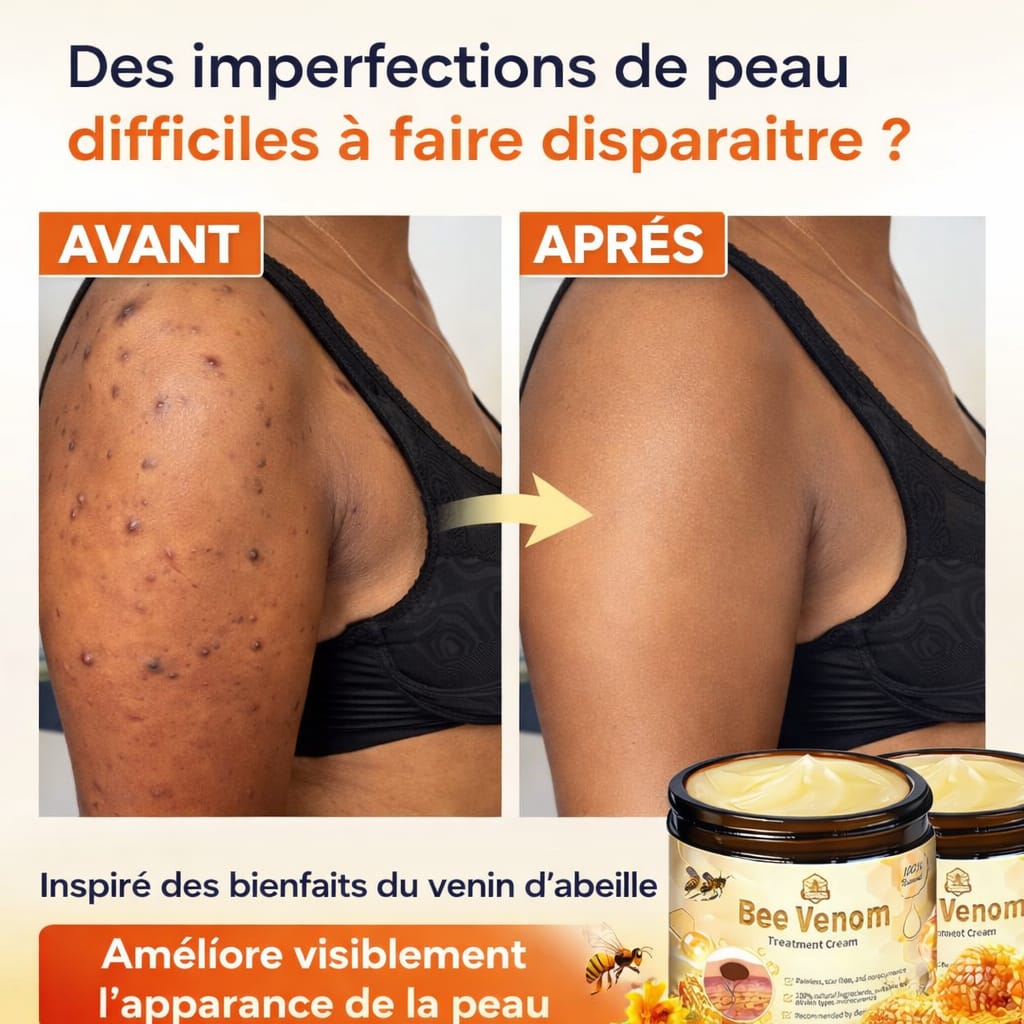 𝐓𝐚𝐠-𝐜𝐮𝐫𝐞 𝐁𝐞𝐞 𝐯𝐞𝐧𝐨𝐦