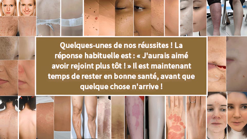 𝐓𝐚𝐠-𝐜𝐮𝐫𝐞 𝐁𝐞𝐞 𝐯𝐞𝐧𝐨𝐦