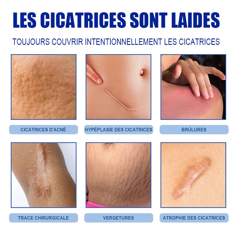 𝐂𝐫𝐞̀𝐦𝐞 𝐫𝐞́𝐩𝐚𝐫𝐚𝐭𝐫𝐢𝐜𝐞 𝐝𝐞 𝐜𝐢𝐜𝐚𝐭𝐫𝐢𝐜𝐞𝐬