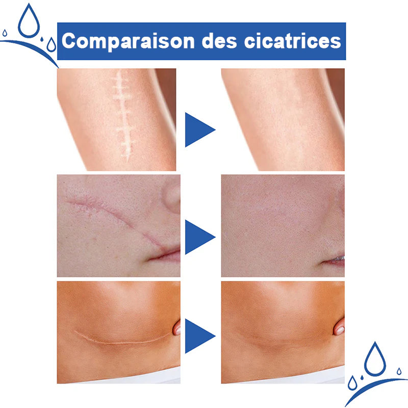 𝐂𝐫𝐞̀𝐦𝐞 𝐫𝐞́𝐩𝐚𝐫𝐚𝐭𝐫𝐢𝐜𝐞 𝐝𝐞 𝐜𝐢𝐜𝐚𝐭𝐫𝐢𝐜𝐞𝐬