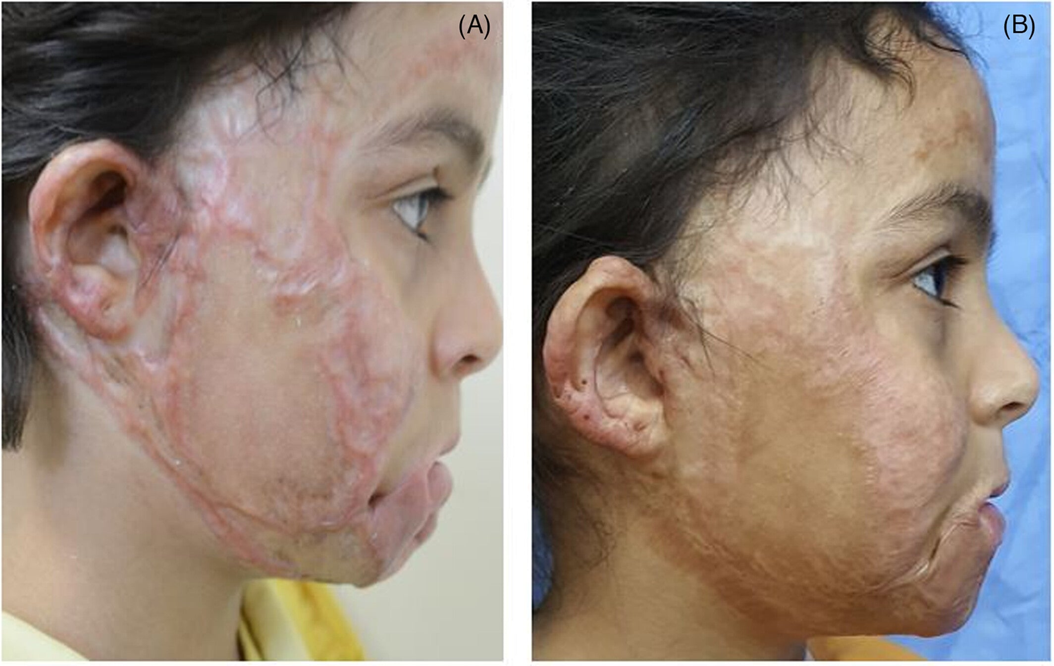 𝐂𝐫𝐞̀𝐦𝐞 𝐫𝐞́𝐩𝐚𝐫𝐚𝐭𝐫𝐢𝐜𝐞 𝐝𝐞 𝐜𝐢𝐜𝐚𝐭𝐫𝐢𝐜𝐞𝐬